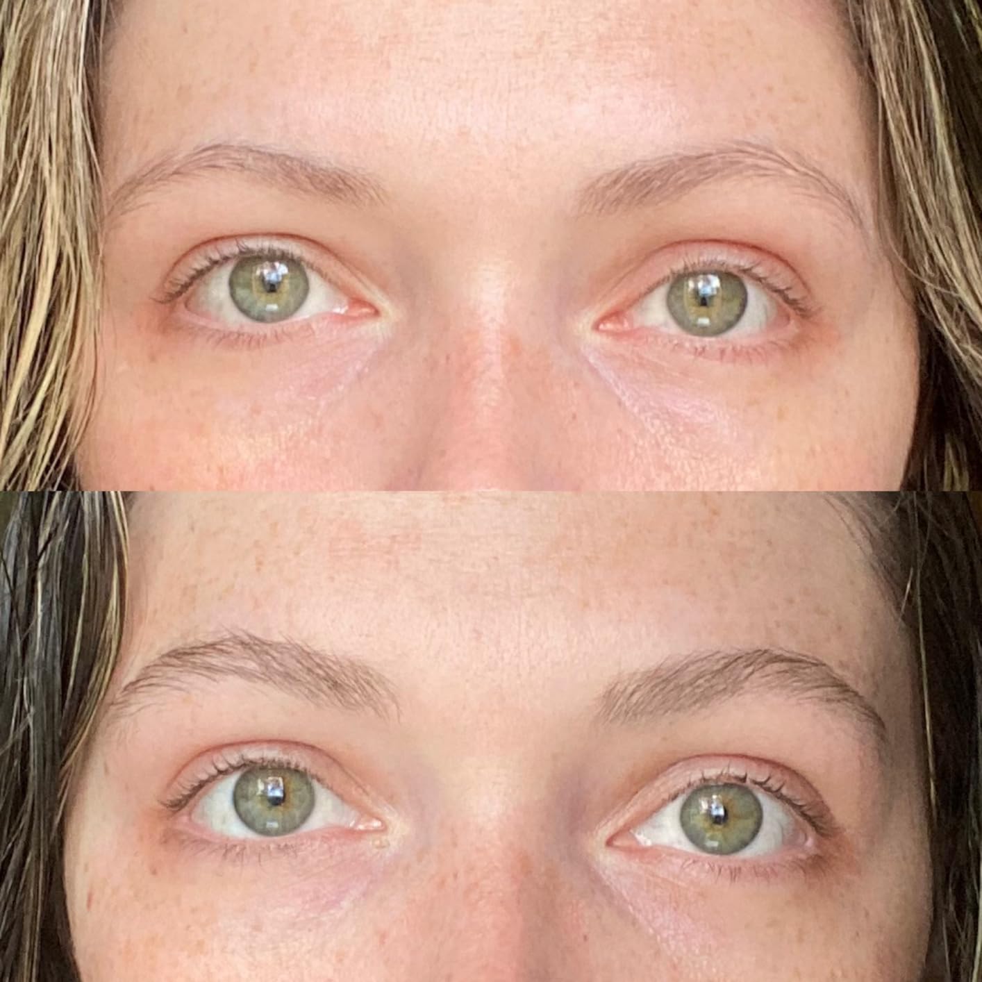 Eyebrow Growth Roller for Fuller, Healthier Brows