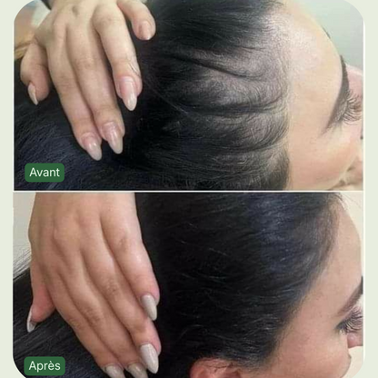 Roll On Booster Woman ®