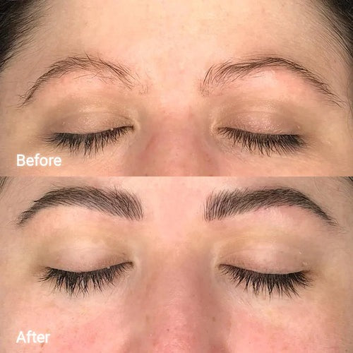 Eyebrow Growth Roller for Fuller, Healthier Brows